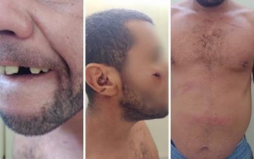 Homem perde dente ao ser agredido com barra de ferro por seguran�as em supermercado de Ara�atuba