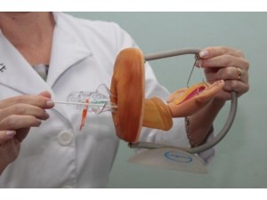 SUS vai substituir papanicolau por exame mais eficaz contra cncer de colo uterino