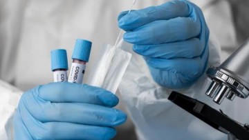 Vigilncia Epidemiolgica confirma apenas um novo caso de covid-19 nesta sexta-feira, 03