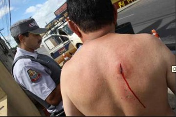 Pipa causa explos�o na rede el�trica e acaba ferindo aposentado