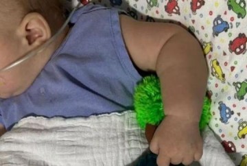 Anvisa libera vacina para prevenir bronquiolite em beb�s