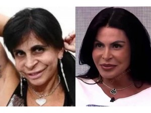 Gretchen faz mudan�a dr�stica no visual e � comparada a Ana Castela: 'Acertou o cirurgi�o'