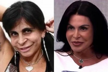 Gretchen faz mudan�a dr�stica no visual e � comparada a Ana Castela: 'Acertou o cirurgi�o'