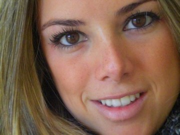 Ex-BBB Fernanda faz lipoaspira��o e coloca silicone