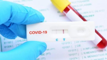 Osvaldo Cruz confirma mais 12 novos casos positivos de Covid-19