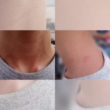 Vereador � acusado de agredir crian�a com autismo em Coroados na regi�o de Ara�atuba