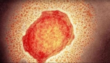 Grupo de Vigil�ncia Epidemiol�gica de Presidente Prudente registra primeiro caso suspeito de monkeypox em 2024