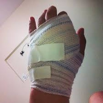 Integrante da coleta seletiva tem ferimento na m�o por causa de material jogado no lixo