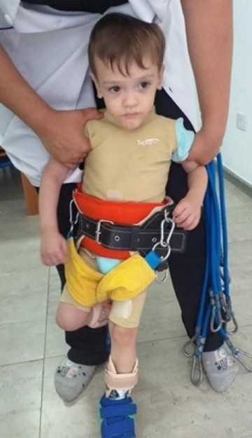 AJUDE O DAVI A ANDAR: saiba como colaborar crian�a que nasceu com 770g a conseguir um andador