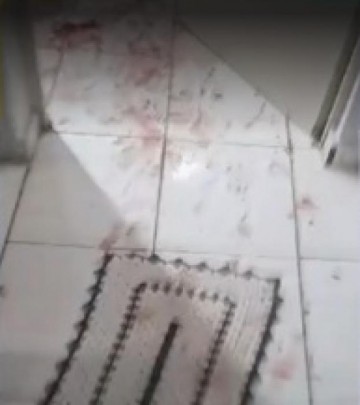 Mulher � agredida e tem cabelo cortado ap�s ex invadir a casa dela pelo telhado