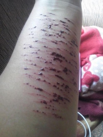 Familiar confirma primeiro caso da Baleia Azul em Osvaldo Cruz