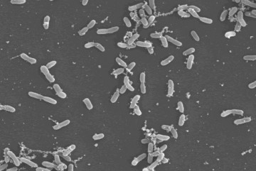 Ministrio monitora infeco por bactria Streptococcus no DF; mdico diz que no h razo para pnico